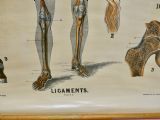 Large University Anatomical Chart “Ligamnets” By Turner photo for sale